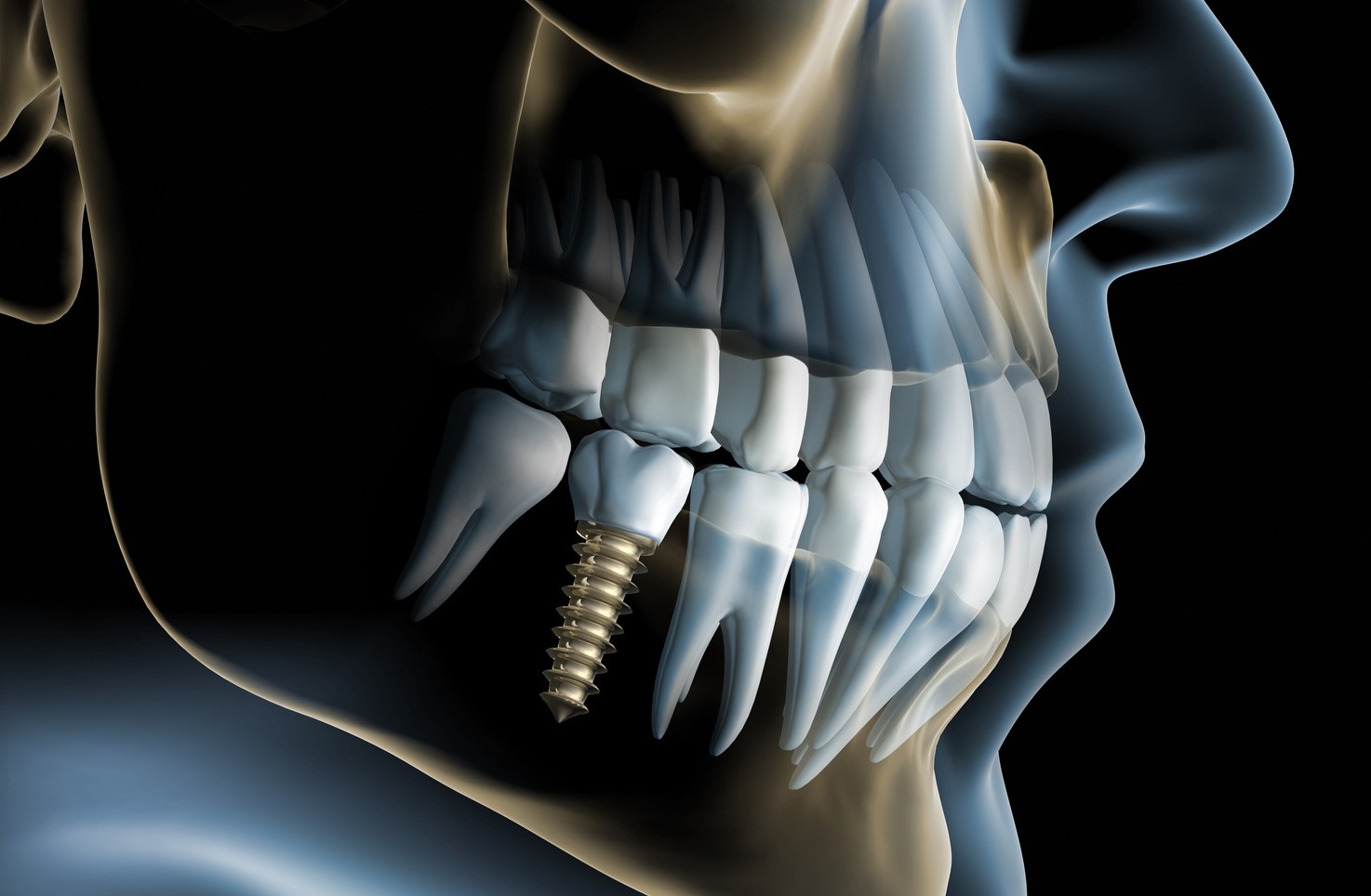 oral surgery scan oral surgery scan